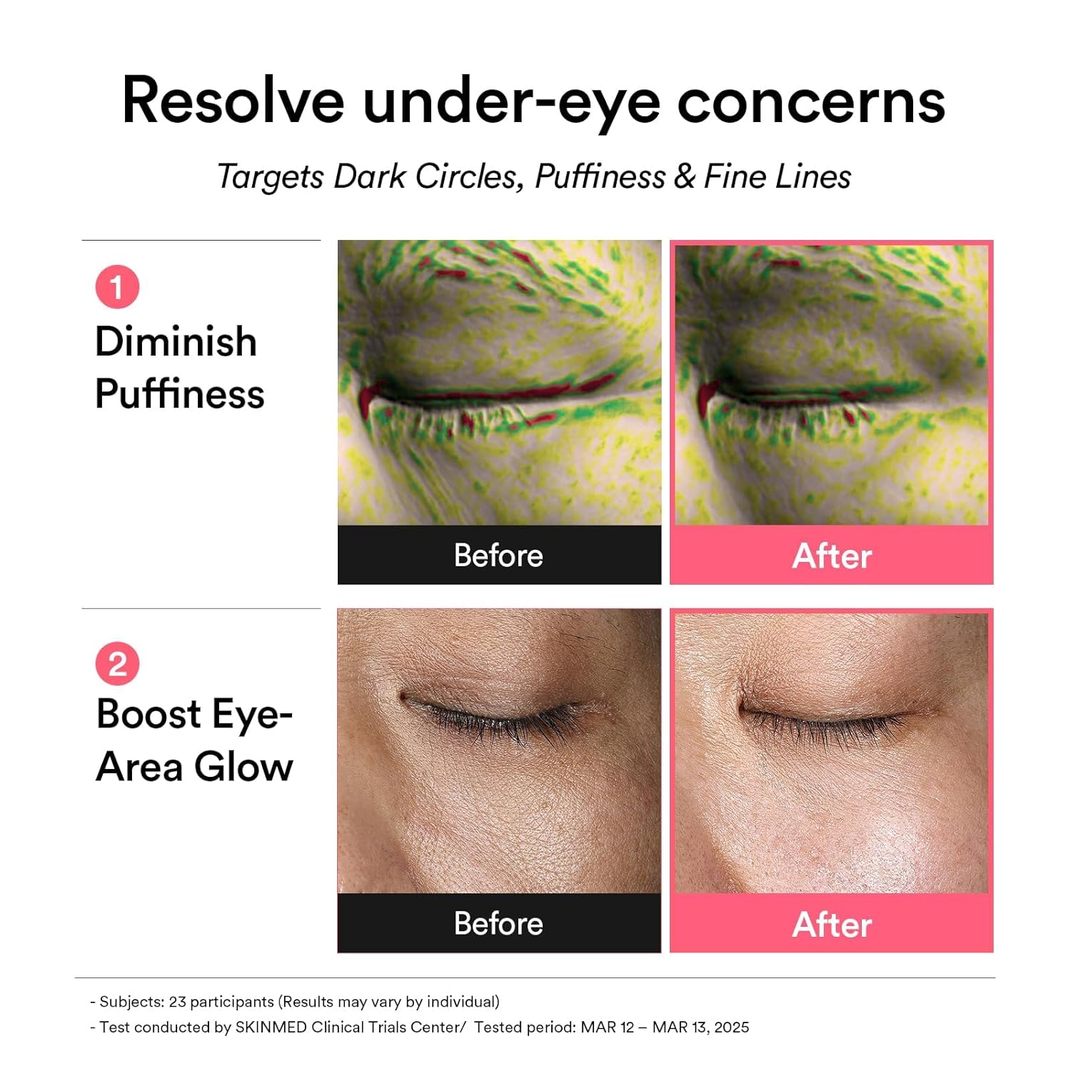 Abib PDRN Retinal Eye Patches